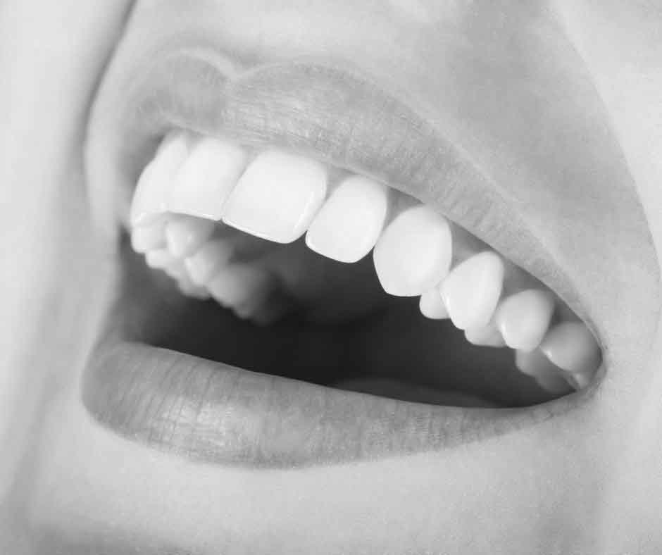 Cracked and Chipped Teeth Treatment Croydon dentist