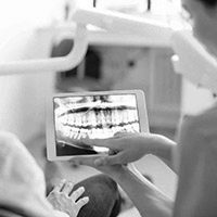 Dental Radiographs