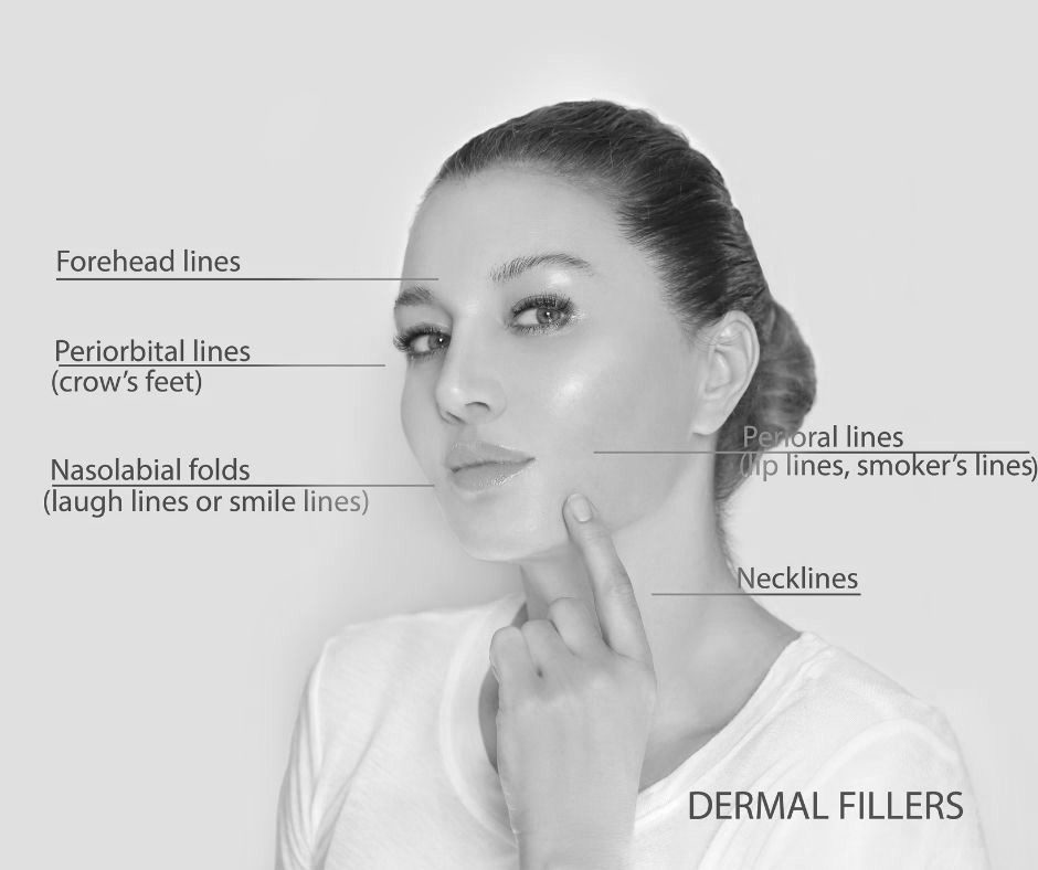 Facial Areas where Fillers and Injectables are Used to Achieve Facial Rejuvenation