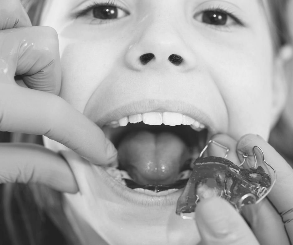 Early Orthodontics