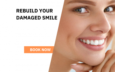 How To Save A Damaged Tooth In Croydon