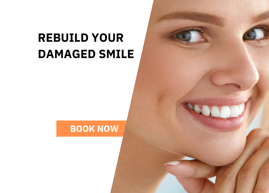 save a damaged tooth in Croydon