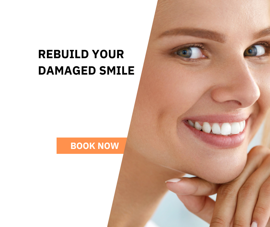 How To Save A Damaged Tooth In Croydon