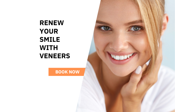 Veneers in Croydon South