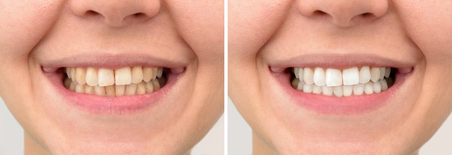 before-and-after-3.1.jpg