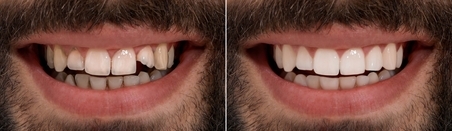 before-and-after-6-.1.jpg