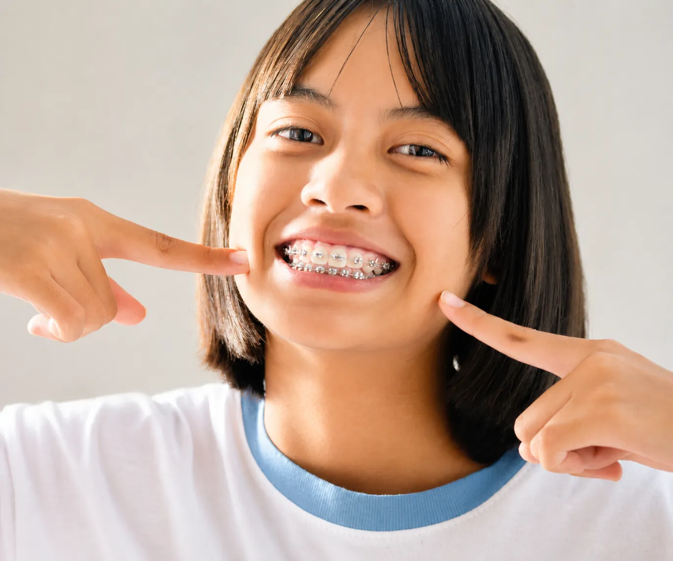 Orthodontic Braces