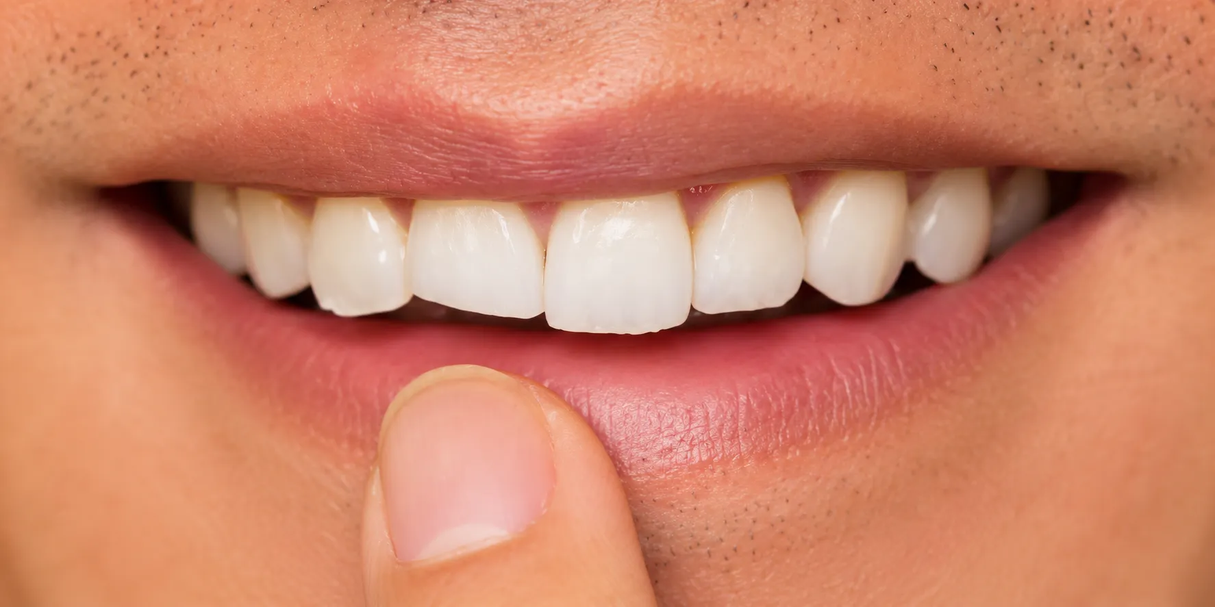 Treatment Croydon Dentist